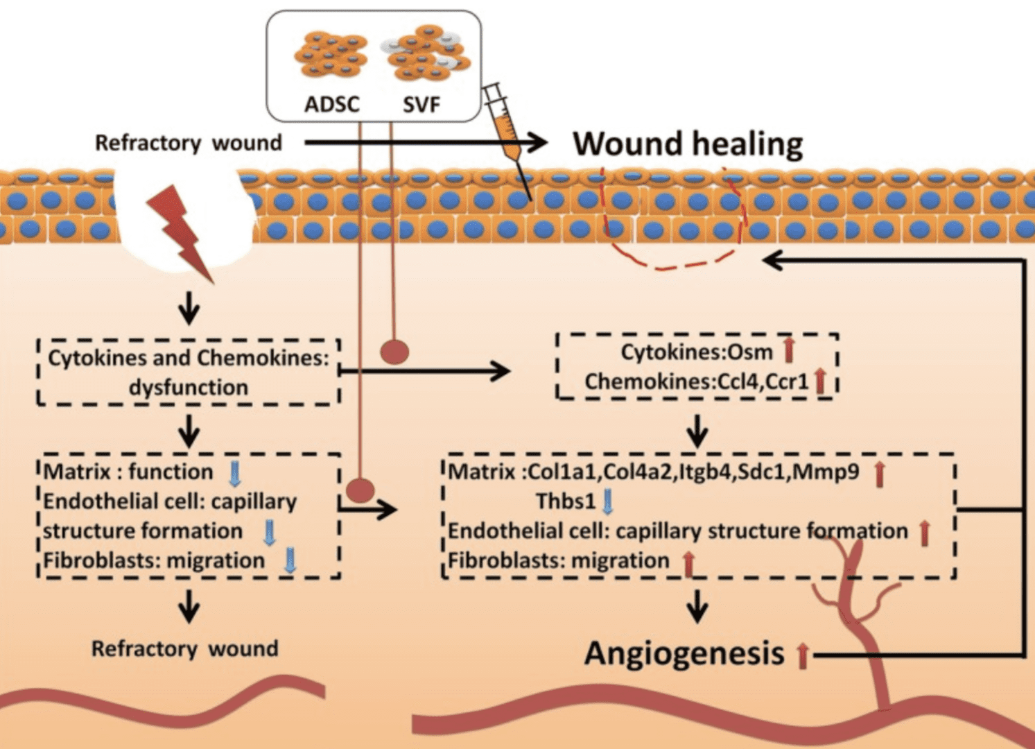 SVF promotes wound healing by inducing angiogenesis, matrix remodeling, and cell migration.

Bi H, Li H, Zhang C, Mao Y, Nie F, Xing Y, Sha W, Wang X, Irwin DM, Tan H. Stromal vascular fraction promotes migration of fibroblasts and angiogenesis through regulation of extracellular matrix in the skin wound healing process. Stem Cell Res Ther. 2019 Oct 17;10(1):302. doi: 10.1186/s13287-019-1415-6. PMID: 31623669; PMCID: PMC6798485.