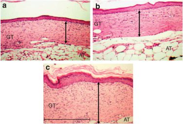 ADV/VEGF165 enhances granulation tissue deposition. 

Brem H, Kodra A, Golinko MS, Entero H, Stojadinovic O, Wang VM, Sheahan CM, Weinberg AD, Woo SL, Ehrlich HP, Tomic-Canic M. Mechanism of sustained release of vascular endothelial growth factor in accelerating experimental diabetic healing. J Invest Dermatol. 2009 Sep;129(9):2275-87. doi: 10.1038/jid.2009.26. Epub 2009 Mar 12. PMID: 19282838.